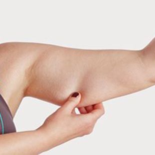 جراحات شد الجسم